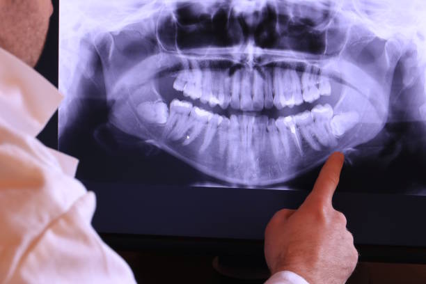 Best Emergency Treatment for Dental Infections or Abscesses in Wasilla, AK