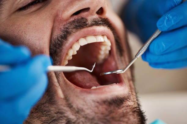 Best Emergency Gum Treatment in Wasilla, AK